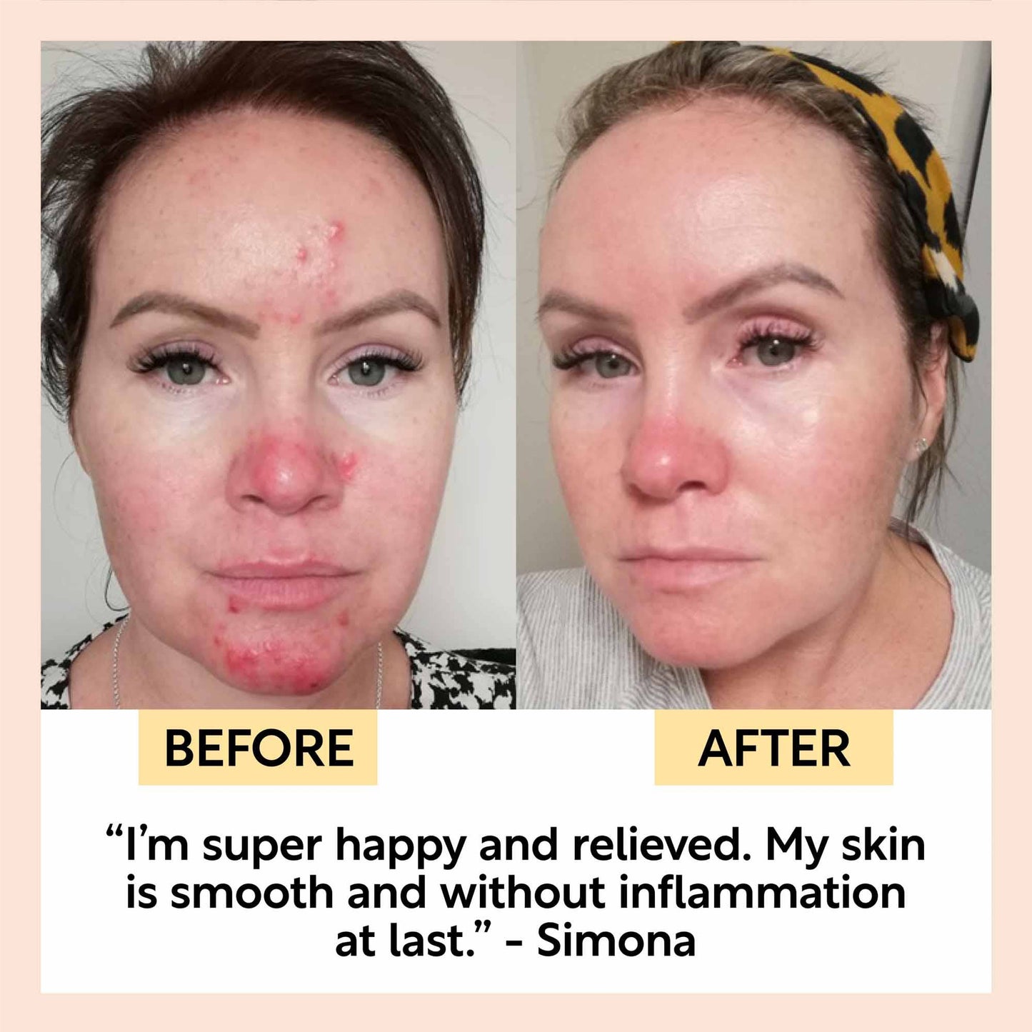Anti-Ageing Night Cream with Hyaluronic Acid + Niacinamide
