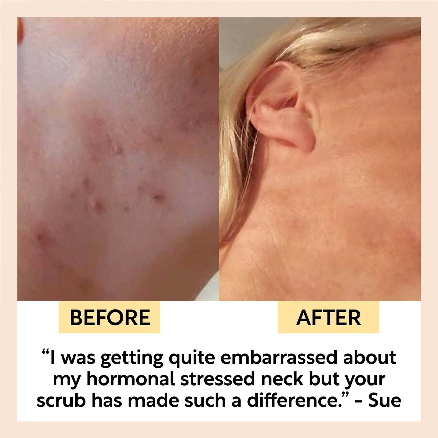 Zero Waste Vegan Face Scrub with Coffee + Rosehip [Citrus blend] Exfoliator